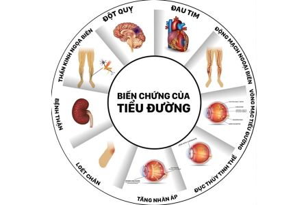 Cẩm nang thông tin cần biết về bệnh tiểu đường